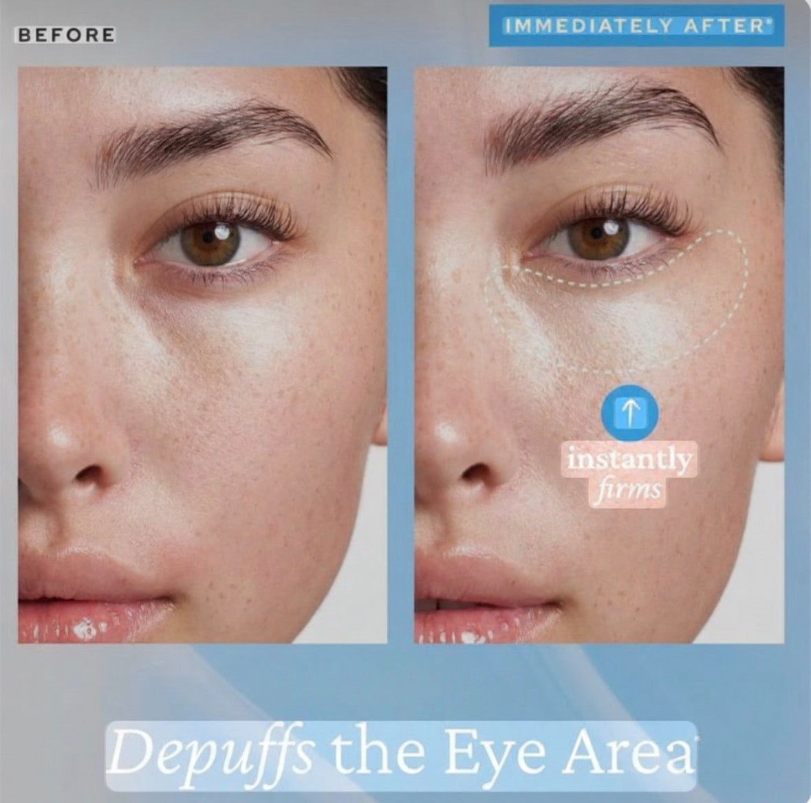 Pink Wink™️ Cooling Eye Gel (Step 1)