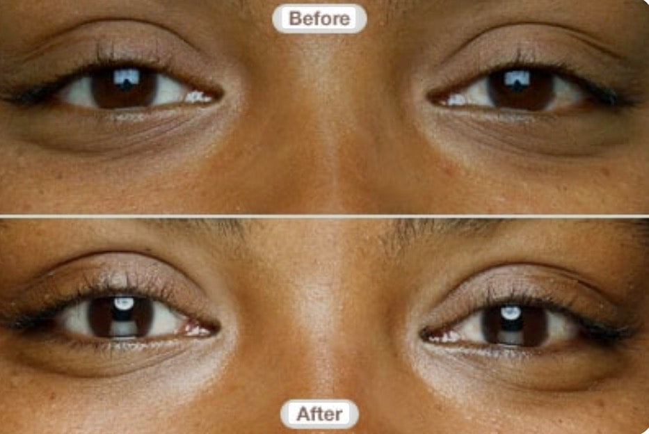 Glow Wink™️ Brightening Eye Cream (Step 2)