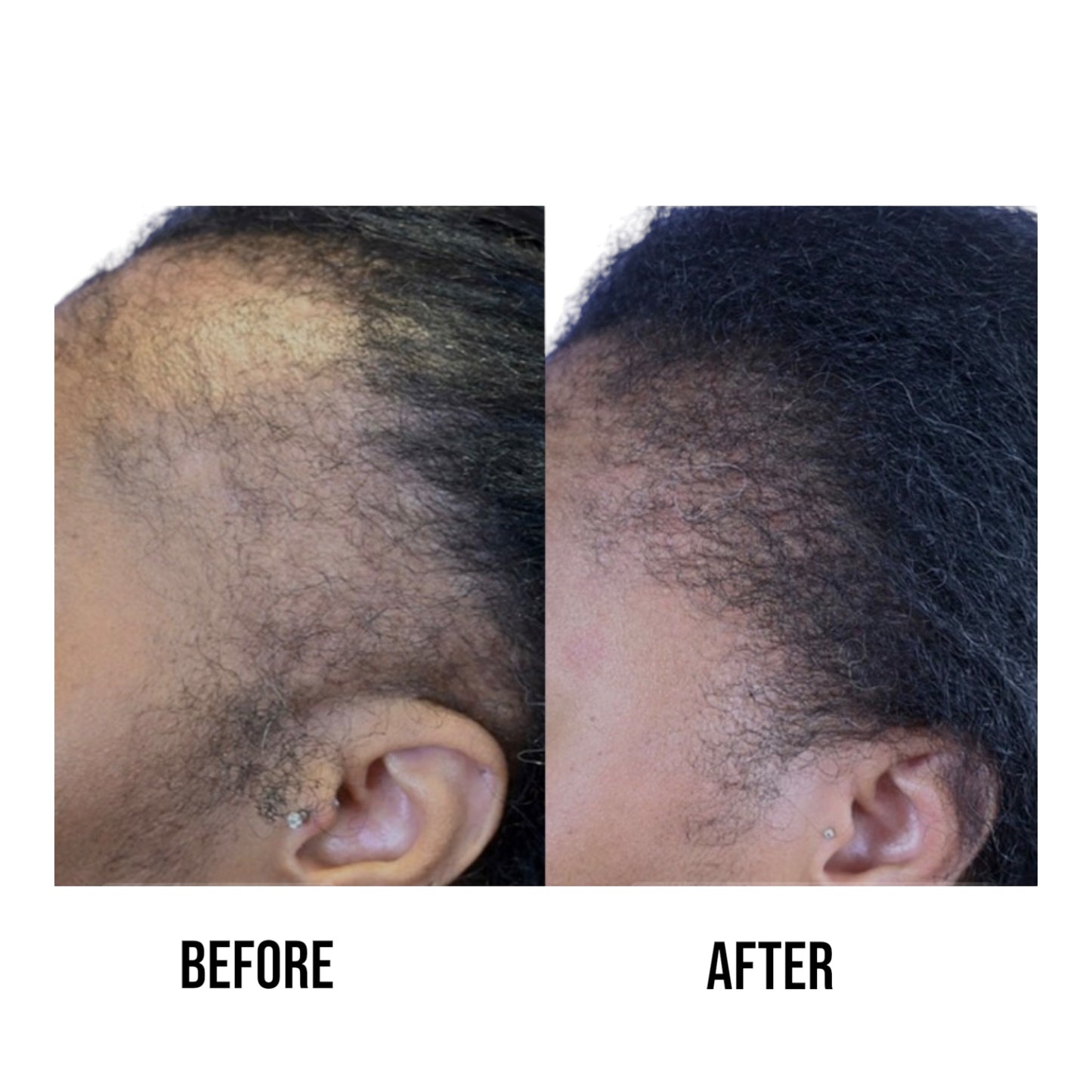 CS3 Hair & Beard Growth Serum